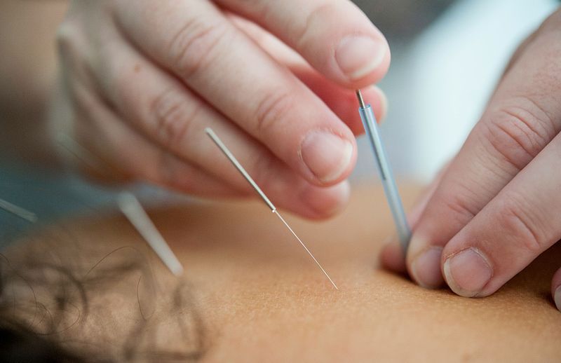 Acupuncturist in Brussels – Traditional Chinese Medicine in Schaerbeek
